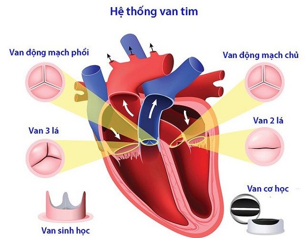 Bệnh tim mạch: Liệu bạn đã thật sự hiểu và biết về nó chưa?