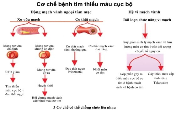 cơ chế bệnh tim thiếu máu cục bộ