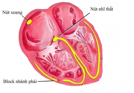 Block phân nhánh