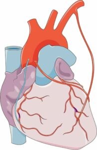 hội chứng mạch vành cấp