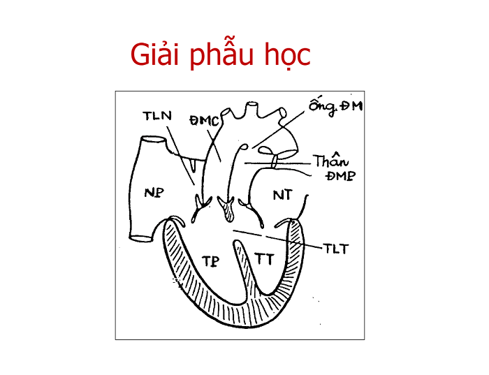 Giải phẫu tim trong bệnh lý Hoán vị đại động mạch