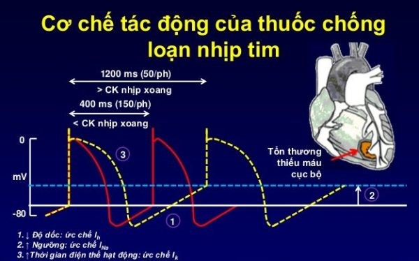 cơ chế hoạt động của thuốc chống loạn nhịp tim