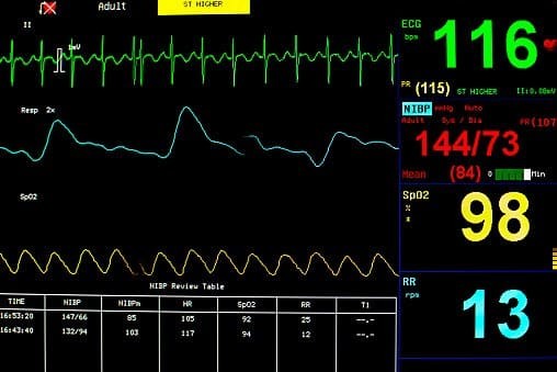 Monitor theo dõi điện tâm đồ