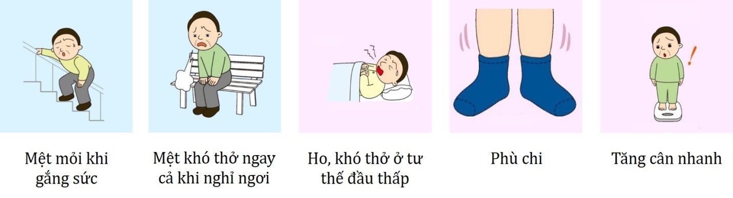 dấu hiệu của viêm cơ tim 